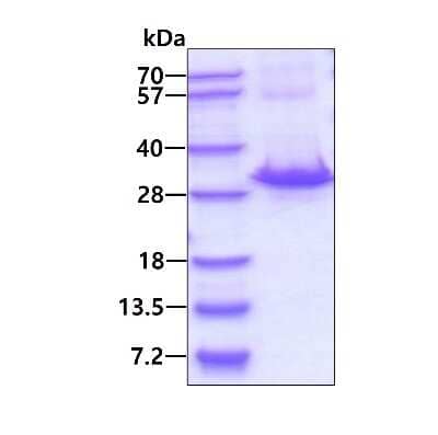 SDS-PAGE: Recombinant Human RAB32 His Protein [NBP1-72487]